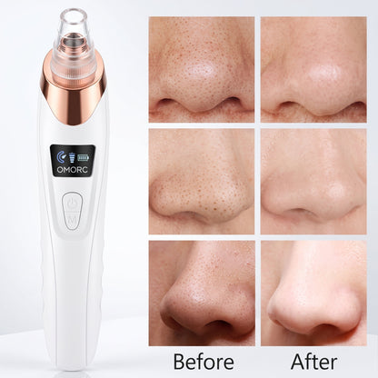 Rechargeable Blackhead Remover Vacuum – 5-Level Pore Cleaner with 4 Suction Heads - Armaa Store Pk